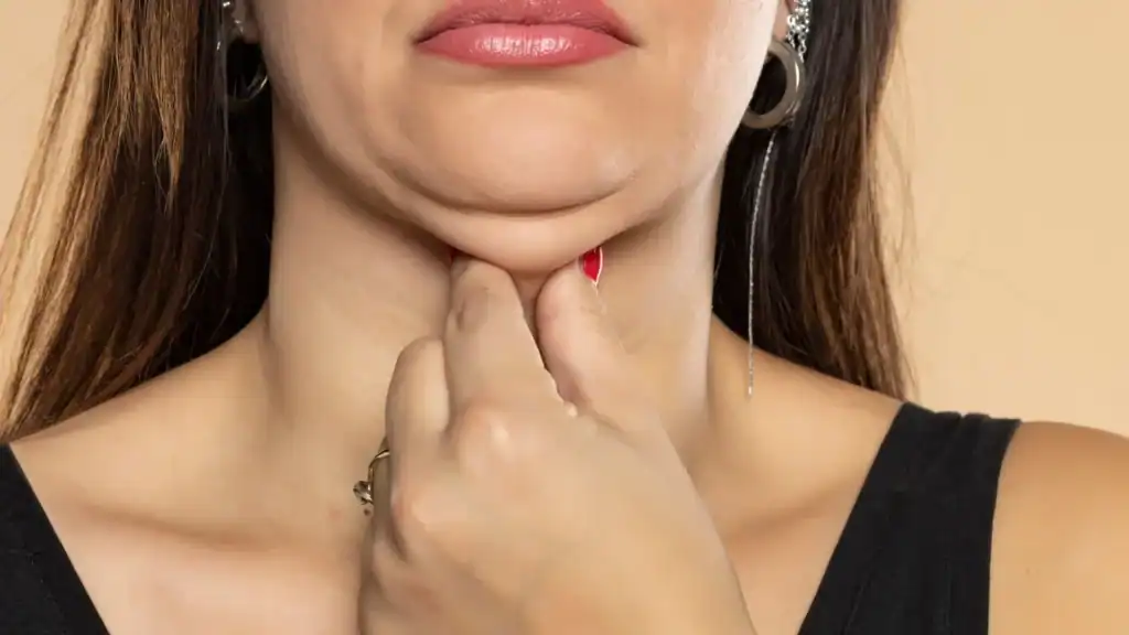 An image of a woman with double chin, sad, worried : Non Surgical Double Chin Removal Treatment in Wednesbury, UK
